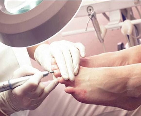 Urasli nokti Zrenjanin